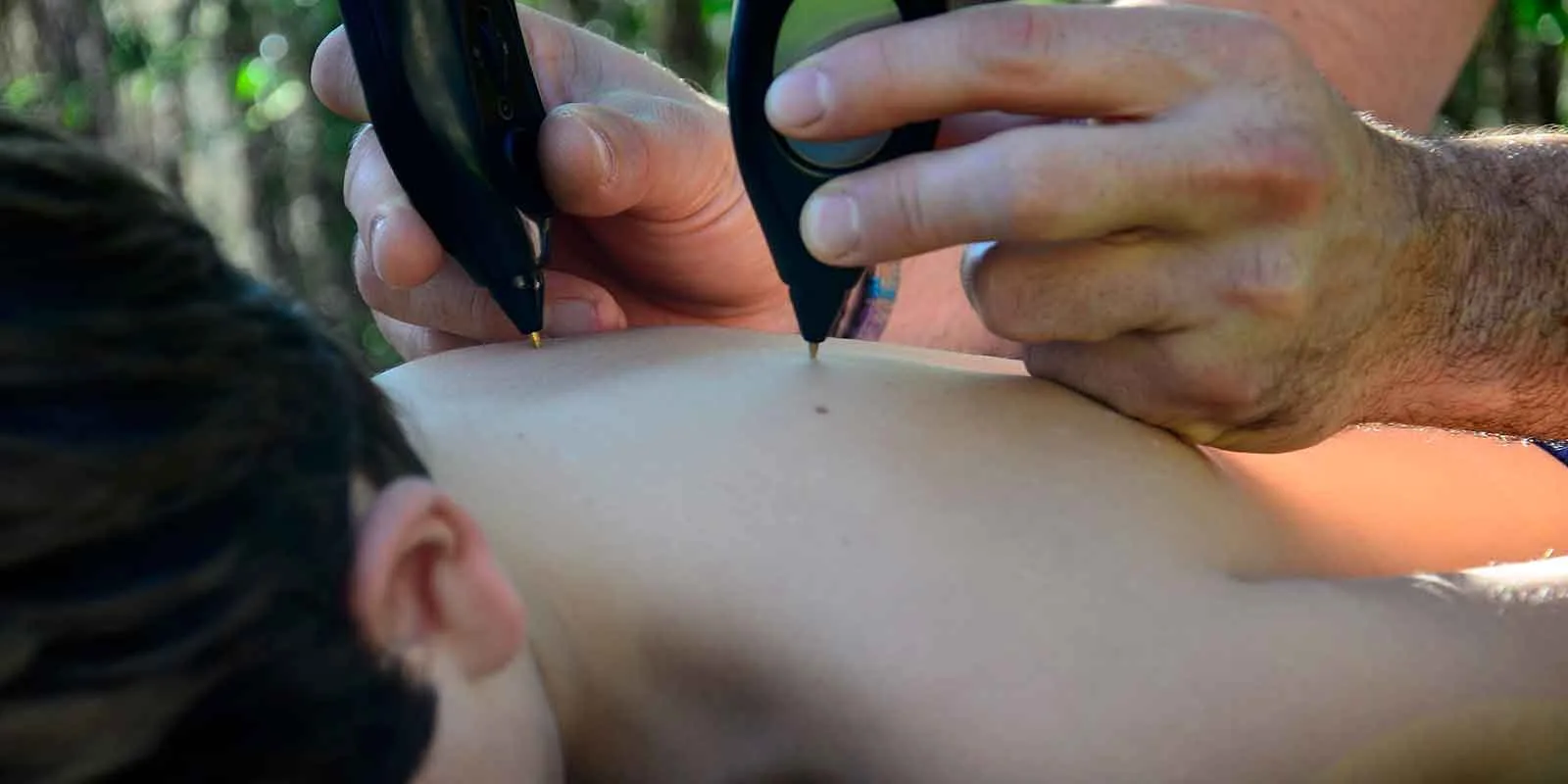 Electro Estimulación: ¿para qué sirve?